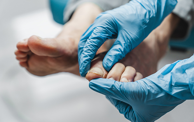 Cirurgia de la uña no invasiva